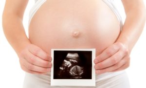co oznacza pośrednie ryzyko trisomii 21, pośrednie ryzyko trisomii 21