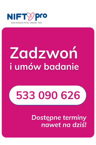 umów NIFTY umów NIFTY